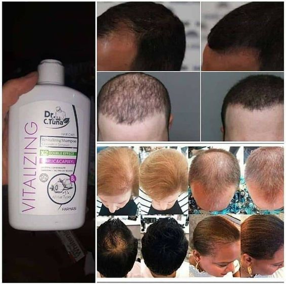 Farmasi fokhagymás sampon Dr. C. Tuna vitalizing regeneráló hajsampon fokhagymával és capixyllel.