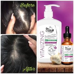 A fokhagymás sampon Dr. C. Tuna vitalizing regeneráló hajsampon fokhagymával és capixyllel.